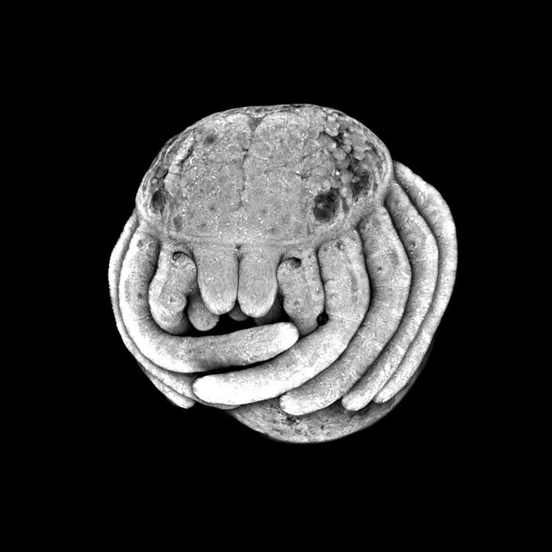 Does anyone think this spider embryo looks like baby Chtulhu image